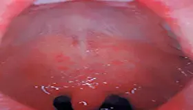 عکس سرخک 1